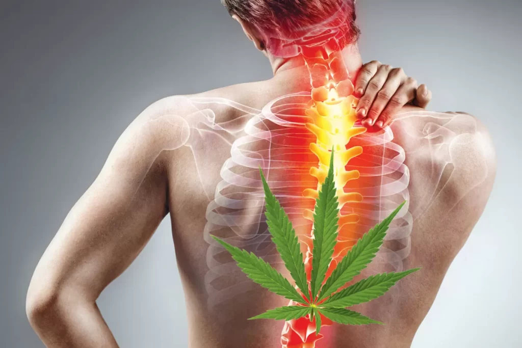 Medical Cannabis as a Back Pain Treatment | Back pain